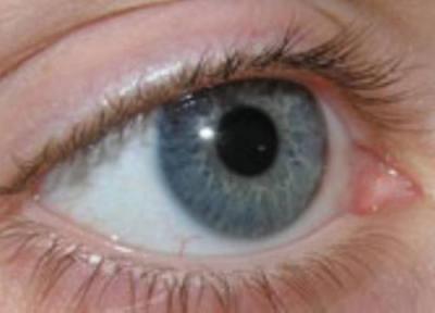 رایج ترین باورهای غلط درباره چشم