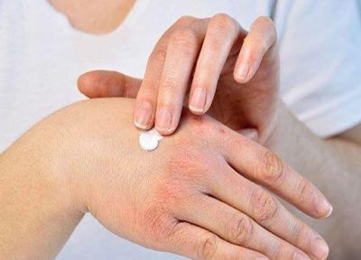 چگونه خشکی پوست دست را رفع کنیم؟